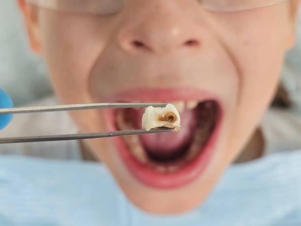 Best Tooth Infection Emergency Dentist  in Burns Flat, OK