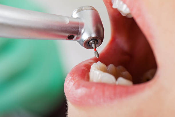 Best Emergency Dentist Near Me  in Burns Flat, OK